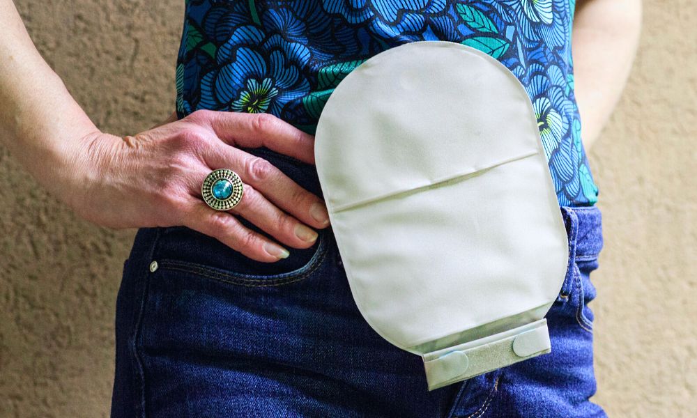 What To Know About Going To Work With an Ostomy Bag