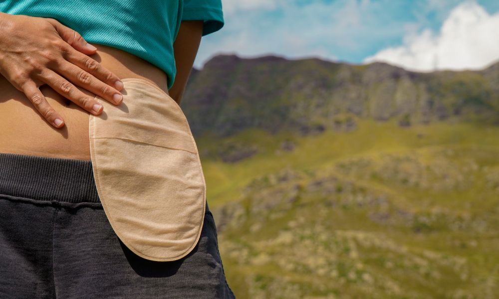 9 Best Exercises You Can Do With an Ostomy Bag